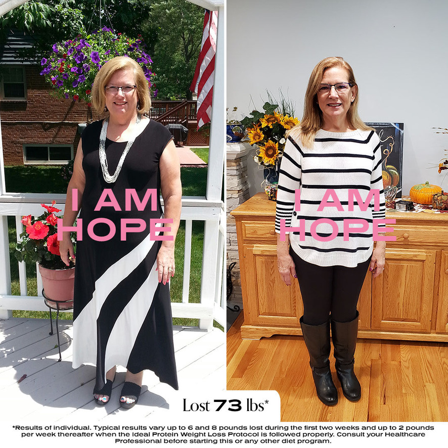 Healthcare Professional Loses 73 Pounds after Gastric Sleeve